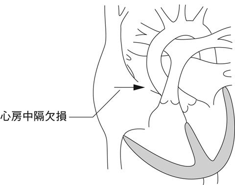 病気事典の図表