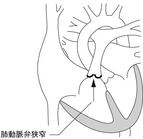 病気事典の図表