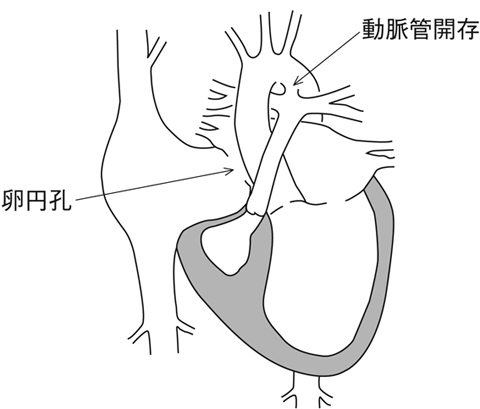 病気事典の図表
