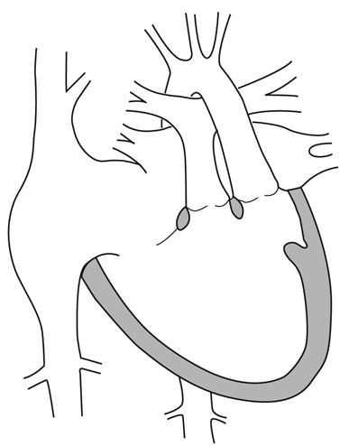 病気事典の図表