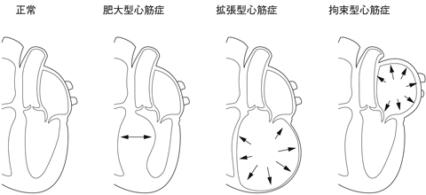 病気事典の図表