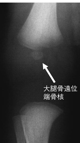 病気事典の図表