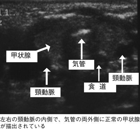 病気事典の図表