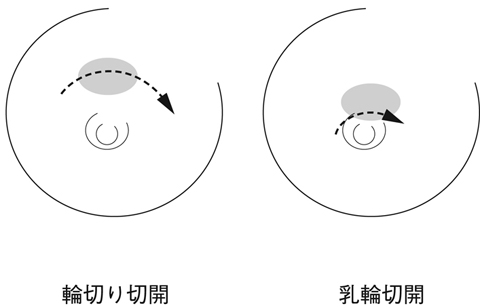 病気事典の図表