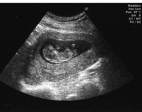 病気事典の図表