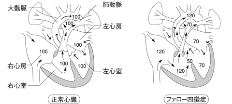病気事典の図表