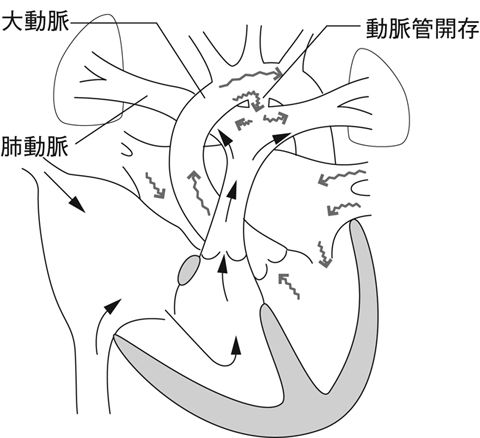 病気事典の図表