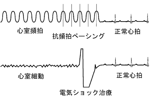 病気事典の図表