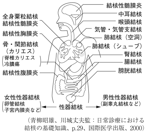 病気事典の図表