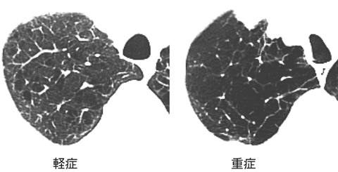病気事典の図表