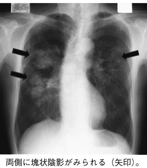 病気事典の図表