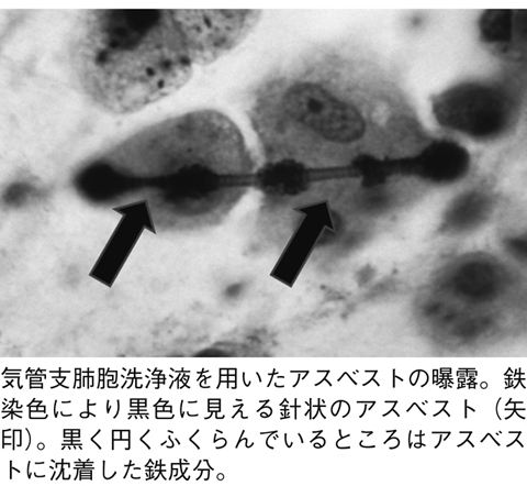 病気事典の図表