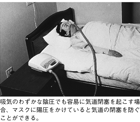 病気事典の図表