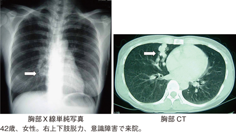 病気事典の図表