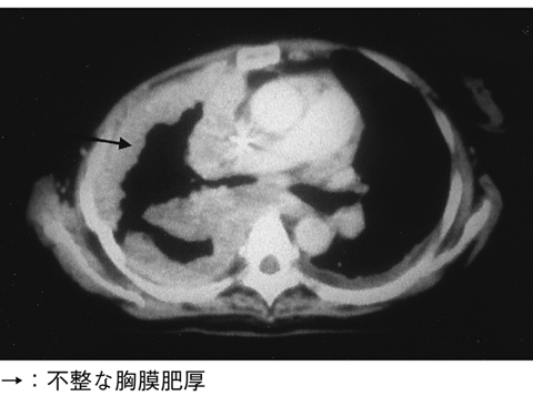 病気事典の図表