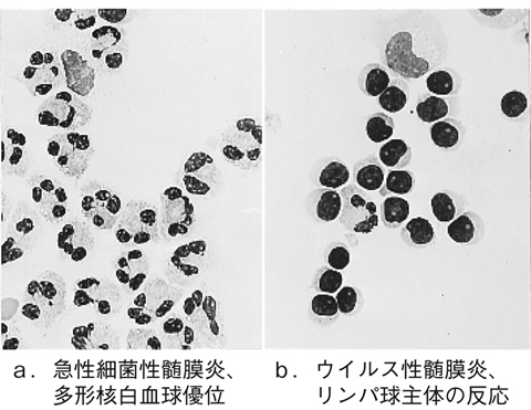 病気事典の図表