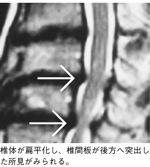 病気事典の図表