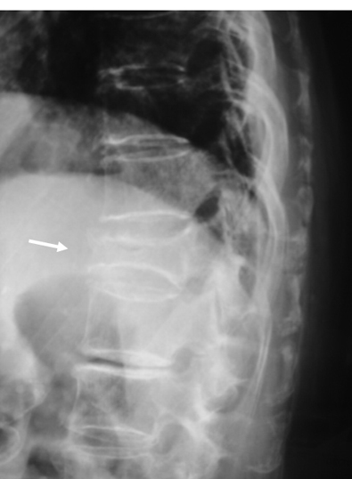 病気事典の図表