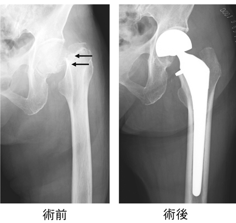 病気事典の図表