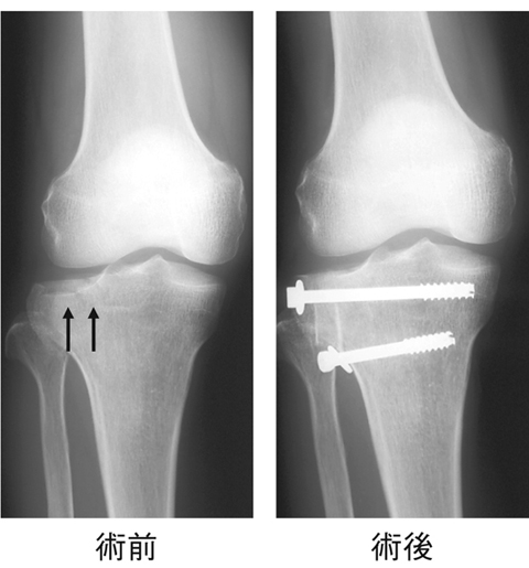 病気事典の図表