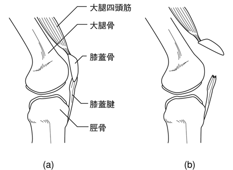 病気事典の図表