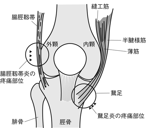 病気事典の図表
