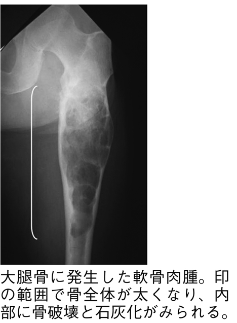 病気事典の図表