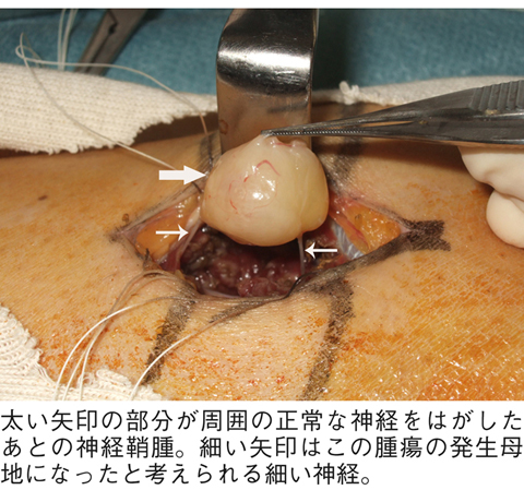 病気事典の図表