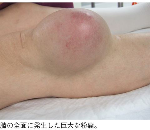 病気事典の図表