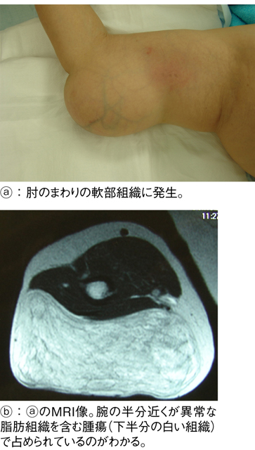 病気事典の図表