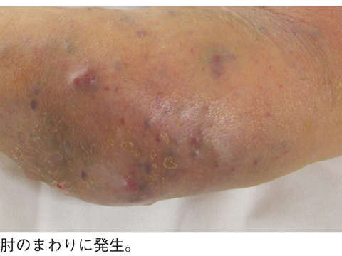 病気事典の図表