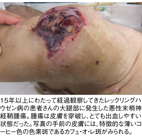 病気事典の図表