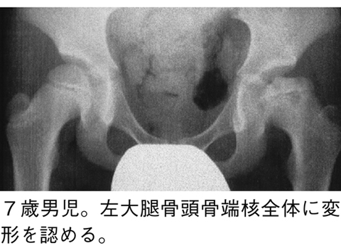 病気事典の図表