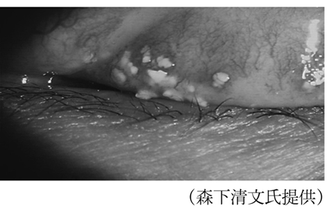 病気事典の図表