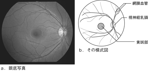 病気事典の図表
