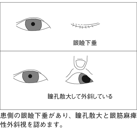 病気事典の図表