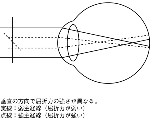 病気事典の図表