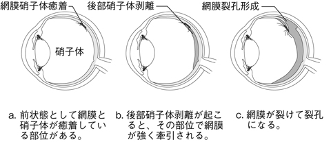 病気事典の図表