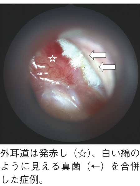 病気事典の図表