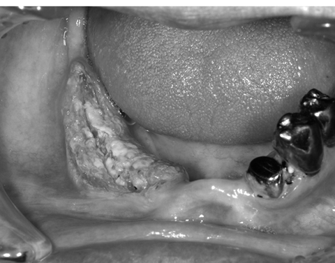 病気事典の図表