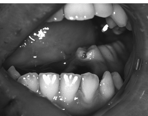 病気事典の図表