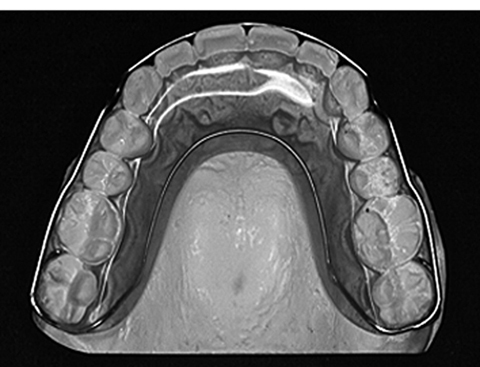 病気事典の図表