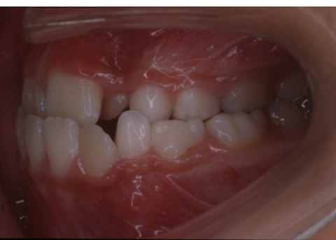 病気事典の図表