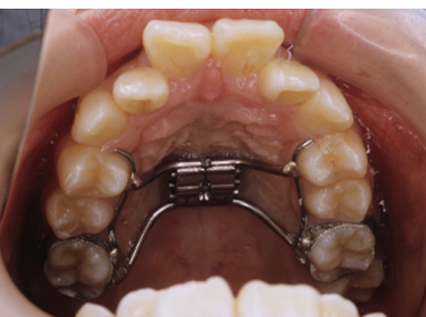 病気事典の図表