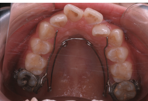 病気事典の図表