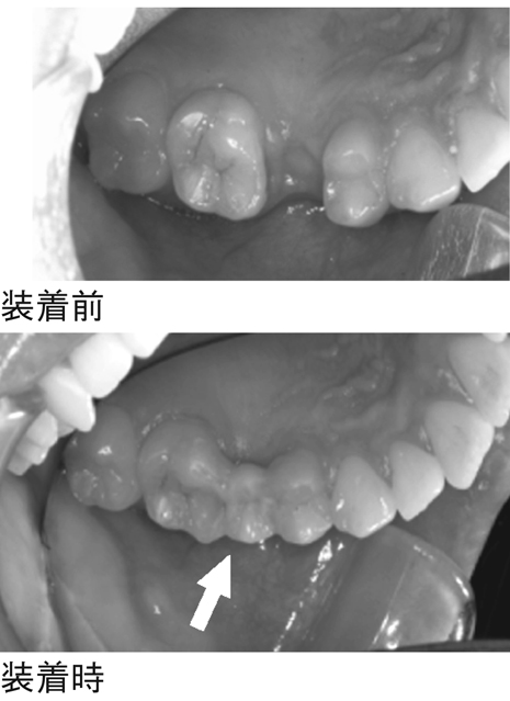 病気事典の図表