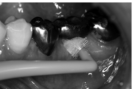 病気事典の図表