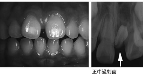 病気事典の図表