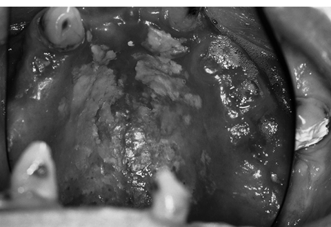 病気事典の図表