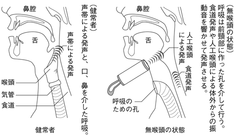 病気事典の図表